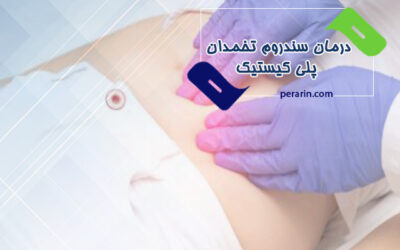 درمان سندروم تخمدان پلی کیستیک