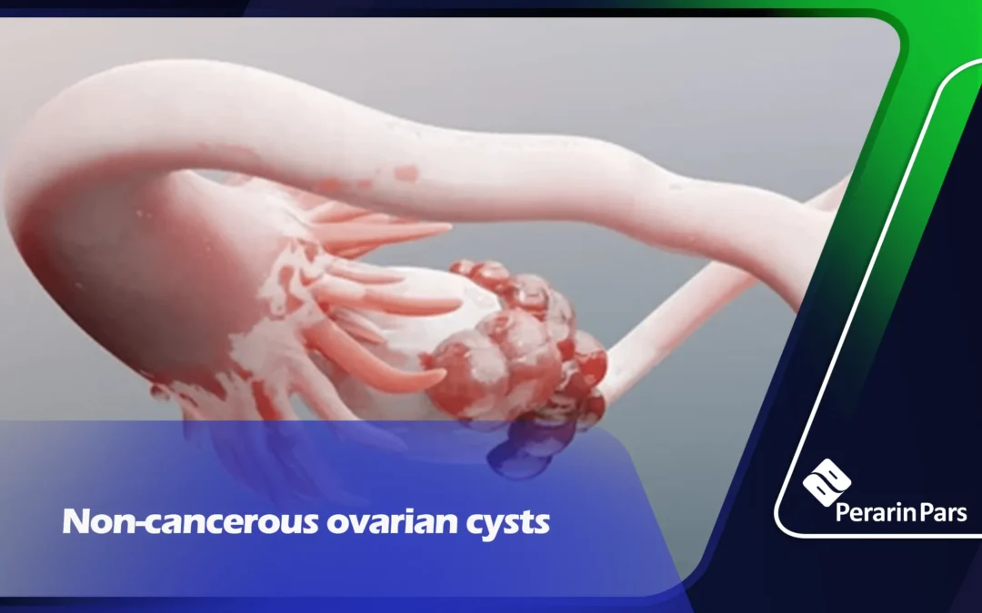 Non-cancerous ovarian cysts