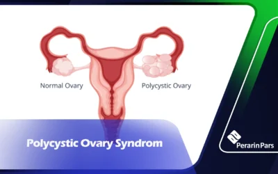 Polycystic Ovary Syndrome (PCOS)