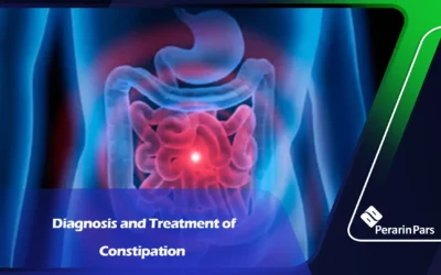 Diagnosis and Treatment of Constipation