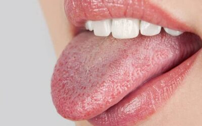 ارتباط کنترل قند خون و خشکی دهان