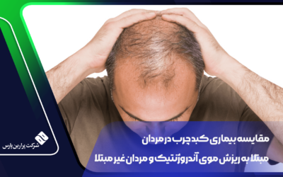 مقایسه بیماری کبد چرب در مردان مبتلا به ریزش موی آندروژنتیک و مردان غیر مبتلا