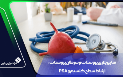 هایپرپلازی پروستات و سرطان پروستات: ارتباط سطح کلسیم و PSA