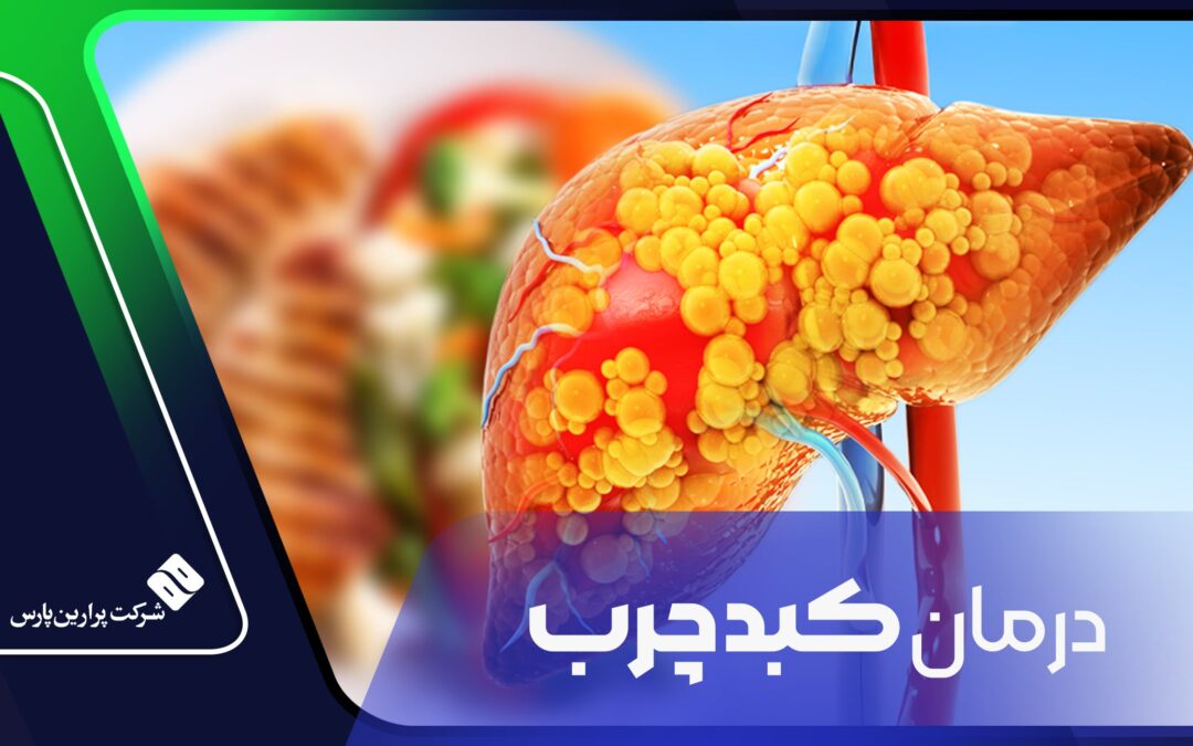 درمان کبد چرب