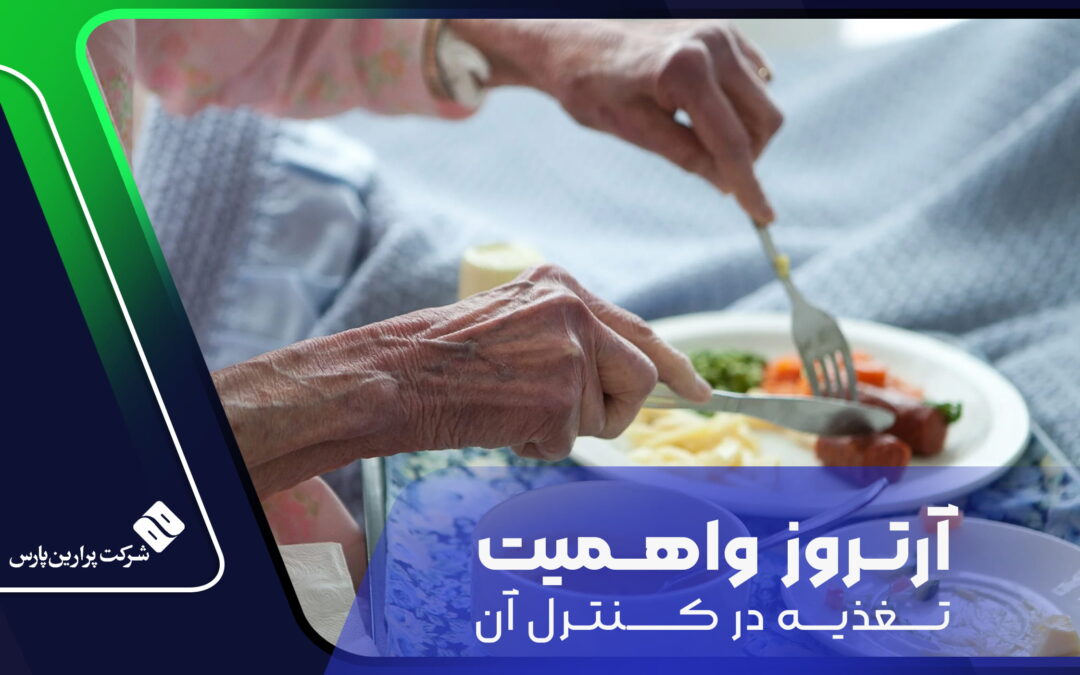 آرتروز و اهمیت تغذیه در کنترل آن